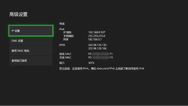 Xbox One玩家福音，VPN路由器助你畅游国际游戏世界,xboxone vpn 路由器,购买VPN服务,第1张